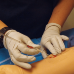 administering anesthesia